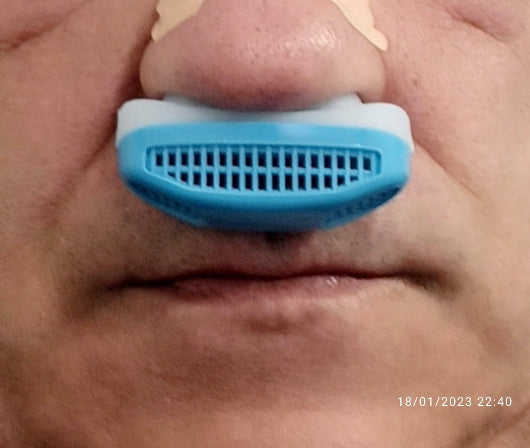 Anti Ronquidos Dilatador Nasal Aire Puro 2 En 1 Dormir - Variante Color  Celeste — Atrix